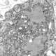 Image for article titled Why Does Rabies Damage Your Body With Such Scary Speed?